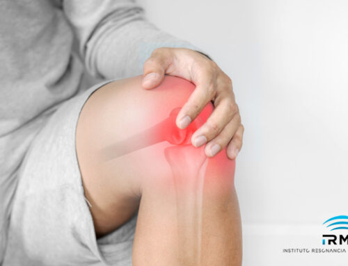 Resonancia magnética de rodilla para el diagnóstico de lesiones  